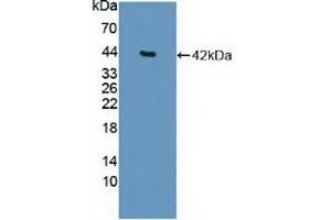 Detection of Recombinant HDAC9, Human using Polyclonal Antibody to Histone Deacetylase 9 (HDAC9)
