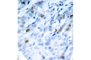 Immunohistochemistry (IHC) image for anti-Cyclin-Dependent Kinase 1 (CDK1) (pThr161) antibody (ABIN3020136) (CDK1 抗体  (pThr161))
