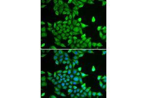 Immunofluorescence analysis of MCF-7 cells using PSMA6 antibody.