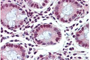 Human Colon (formalin-fixed, paraffin-embedded) stained with FUBP1 antibody ABIN462199 followed by biotinylated goat anti-rabbit IgG secondary antibody ABIN481713, alkaline phosphatase-streptavidin and chromogen. (FUBP1 抗体  (AA 540-589))