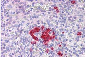 Immunohistochemistry (Formalin-fixed Paraffin-embedded Sections) (IHC (fp)) image for anti-Forkhead Box O4 (FOXO4) (N-Term) antibody (ABIN625927)