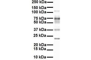 WB Suggested Anti-SLC27A3 antibody Titration: 1 ug/mL Sample Type: Human MCF7 (SLC27A3 抗体  (Middle Region))