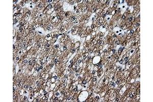 Immunohistochemical staining of paraffin-embedded liver tissue using anti-GBE1mouse monoclonal antibody. (GBE1 抗体)