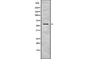 Western blot analysis of Cytochrome P450 4F8 using Jurkat whole cell lysates
