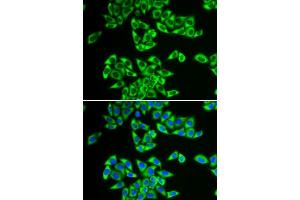 Immunofluorescence analysis of HeLa cells using DDX3X antibody. (DDX3X 抗体  (AA 1-220))