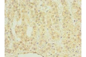 Immunohistochemistry of paraffin-embedded human adrenal gland tissue using ABIN7147636 at dilution of 1:100 (CHAD 抗体  (AA 23-359))