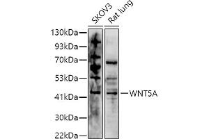 Western blot analysis of extracts of various cell lines, using (ABIN6134458, ABIN6150248, ABIN6150249 and ABIN6216485) at 1:1000 dilution. (WNT5A 抗体  (AA 250-350))