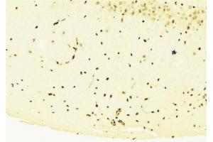 ABIN6276281 at 1/100 staining Mouse brain tissue by IHC-P. (STAT1 抗体  (C-Term))