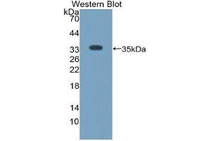 Western Blotting (WB) image for anti-Angiopoietin-Like 4 (ANGPTL4) (AA 183-401) antibody (Biotin) (ABIN1174067) (ANGPTL4 抗体  (AA 183-401) (Biotin))