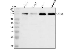Western blot analysis of TAS1R2 using anti-TAS1R2 antibody (ABIN7602701).