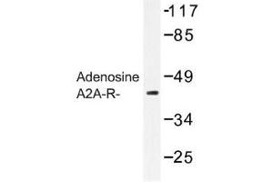 Image no. 1 for anti-Adenosine A2a Receptor (ADORA2A) antibody (ABIN317694) (Adenosine A2a Receptor 抗体)