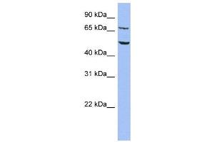 WB Suggested Anti-REPIN1  Antibody Titration: 0. (REPIN1 抗体  (Middle Region))