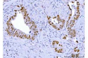 IHC analysis of TP53 using anti-TP53 antibody (ABIN7599050). (p53 抗体  (AA 1-186))