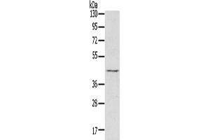 Gel: 8 % SDS-PAGE, Lysate: 60 μg, Lane: Raji cells, Primary antibody: ABIN7130829(RASSF7 Antibody) at dilution 1/800, Secondary antibody: Goat anti rabbit IgG at 1/8000 dilution, Exposure time: 5 seconds (RASSF7 抗体)