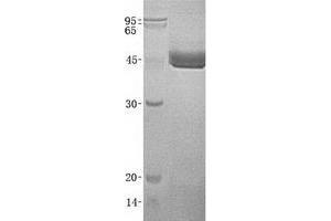 Validation with Western Blot (CD177 Protein (His tag))
