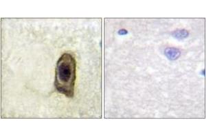 Immunohistochemistry (IHC) image for anti-Colony Stimulating Factor 1 Receptor (CSF1R) (AA 531-580), (pTyr561) antibody (ABIN1531563)