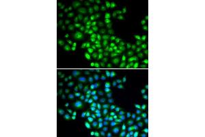 Immunofluorescence analysis of U2OS cells using FOXP1 antibody (ABIN5973033). (FOXP1 抗体)