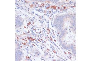 Immunohistochemistry (IHC) image for anti-Vasodilator-Stimulated phosphoprotein (VASP) (AA 1-100) antibody (ABIN6150064)