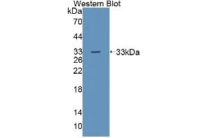 Detection of Recombinant TESK1, Human using Polyclonal Antibody to Testis Specific Kinase 1 (TESK1) (TSSK1 抗体  (AA 57-314))