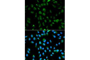 Immunofluorescence analysis of MCF-7 cells using PSMA3 antibody (ABIN5970587). (PSMA3 抗体)