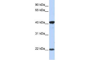 WB Suggested Anti-LIN7C Antibody Titration:  1 ug/ml  Positive Control:  MCF-7 whole cell lysates LIN7C is supported by BioGPS gene expression data to be expressed in MCF7 (LIN7C 抗体  (Middle Region))