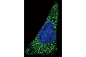Immunofluorescence (IF) image for anti-Solute Carrier Family 11 (Proton-Coupled Divalent Metal Ion Transporters), Member 2 (SLC11A2) antibody (ABIN2997547) (SLC11A2 抗体)
