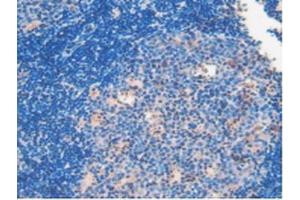 IHC-P analysis of Mouse Lymph Node Tissue, with DAB staining. (Involucrin 抗体  (AA 301-460))