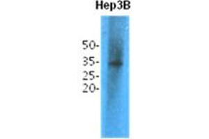 Image no. 1 for anti-Thiopurine S-Methyltransferase (TPMT) antibody (ABIN1490629) (TPMT 抗体)