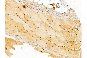 ABIN7094233 and ABIN7098280 at 1/100 staining Rat skin tissue by IHC-P.