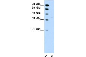 WB Suggested Anti-HSD17B1 Antibody Titration:  0. (HSD17B1 抗体  (N-Term))