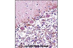 Immunohistochemistry (Paraffin-embedded Sections) (IHC (p)) image for anti-Retinoic Acid Receptor, alpha (RARA) (AA 322-349), (C-Term) antibody (ABIN657770)