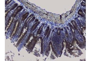 IHC analysis of NRF1 using anti-NRF1 antibody (ABIN6719347).