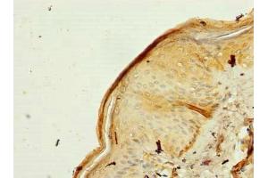 Immunohistochemistry of paraffin-embedded human skin tissue using ABIN7142443 at dilution of 1:100 (MRPL53 抗体  (AA 8-113))