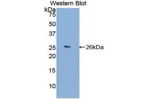 Western Blotting (WB) image for anti-Filamin C, gamma (FLNC) (AA 2519-2725) antibody (ABIN1858904) (FLNC 抗体  (AA 2519-2725))