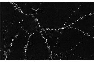 Immunofluorescence staining in dissociated hippocampal neurons with Psd monoclonal antibody, clone 6G6 .