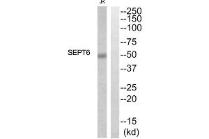 Western blot analysis of extracts from Jurkat cells, using SEPT6 antibody. (Septin 6 抗体  (Internal Region))
