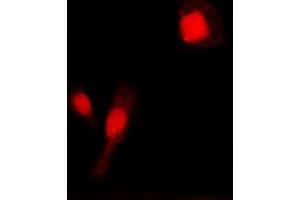 Immunofluorescence (IF) image for anti-Matrix Metalloproteinase 2 (MMP2) (C-Term) antibody (ABIN7296312)