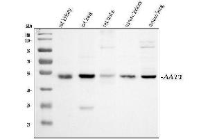 Western blot analysis of SERPINA1 using anti-SERPINA1 antibody (ABIN3043431).