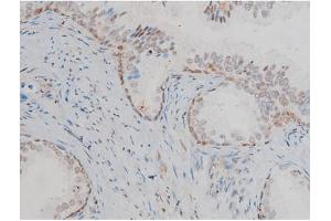 Immunohistochemistry (IHC) image for anti-Gap Junction Protein, alpha 1, 43kDa (GJA1) (pSer368) antibody (ABIN6256297)
