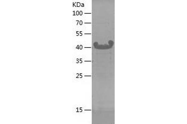 GNAS Protein (AA 47-245) (His tag)