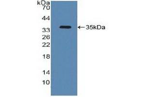Detection of Recombinant ATF4, Human using Polyclonal Antibody to Activating Transcription Factor 4 (ATF4) (ATF4 抗体  (AA 130-347))