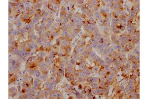 Immunohistochemistry (IHC) image for anti-Clusterin (CLU) antibody (ABIN7127430)