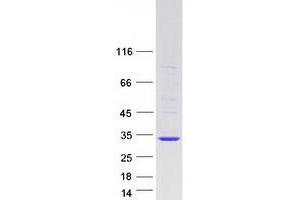 Western Blotting (WB) image for Related RAS Viral (R-Ras) Oncogene Homolog 2 (RRAS2) (Transcript Variant 1) protein (Myc-DYKDDDDK Tag) (ABIN2731195)