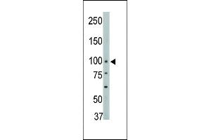 Western Blotting (WB) image for anti-Protein tyrosine Phosphatase, Non-Receptor Type 3 (PTPN3) (AA 366-397) antibody (ABIN392839)