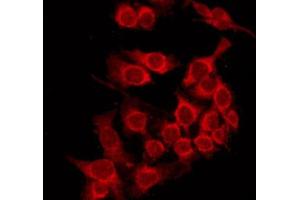ABIN6274024 staining HepG2 by IF/ICC. (MHC, Class I 抗体)