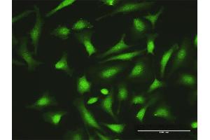 Immunofluorescence of purified MaxPab antibody to ZNF511 on HeLa cell. (ZNF511 抗体  (AA 1-252))