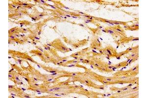 Immunohistochemistry of paraffin-embedded human heart tissue using ABIN7145958 at dilution of 1:100 (CCL15 抗体  (AA 22-113))