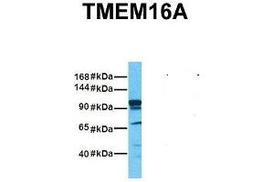 Host:  Rabbit  Target Name:  TMEM16A  Sample Tissue:  Human Fetal Liver  Antibody Dilution:  1. (ANO1 抗体  (Middle Region))