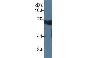 Detection of CCDC60 in Mouse Serum using Polyclonal Antibody to Coiled Coil Domain Containing Protein 60 (CCDC60) (CCDC60 抗体  (AA 1-186))