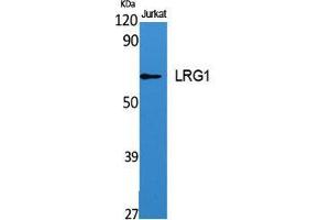 Western Blot (WB) analysis of specific cells using LRG1 Polyclonal Antibody. (LRG1 抗体  (C-Term))